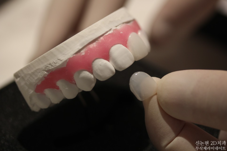 남유정 꼬북좌 거북왕 브브걸 유정 블랙필름 라미네이트 : 노빠꾸탁재훈에서? 관련 이미지 5