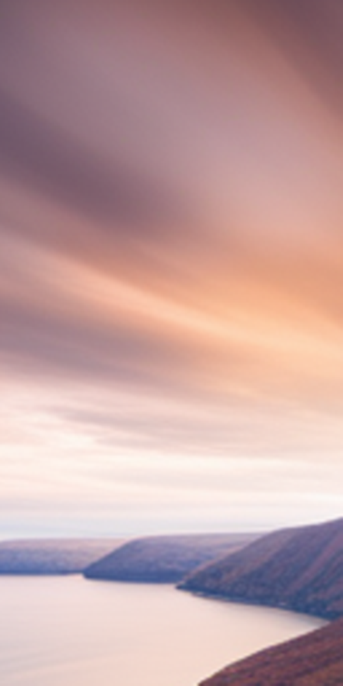 치과라미네이트 비용보다 중요한 것은? 관련 이미지 13