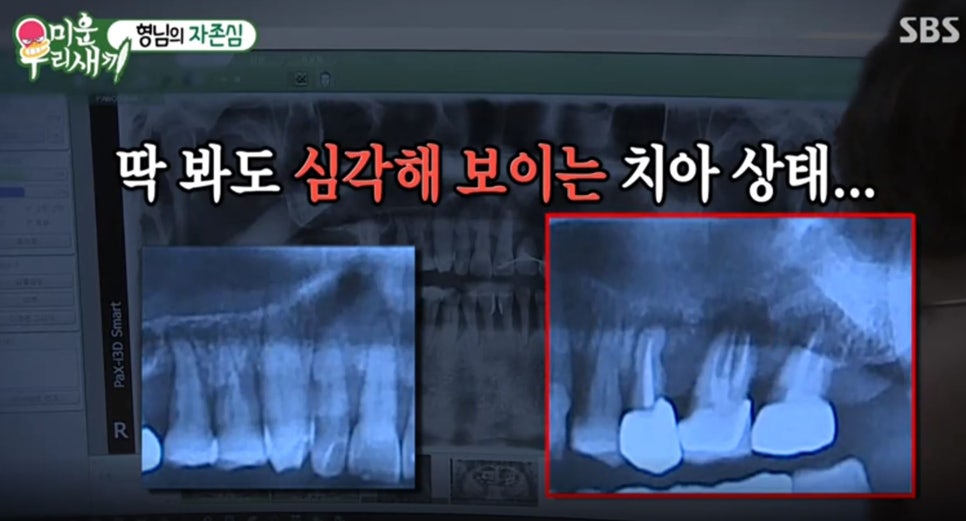 미운우리새끼에서 김보성님이 2D(투디)치과에 오셨다니!! 관련 이미지 8