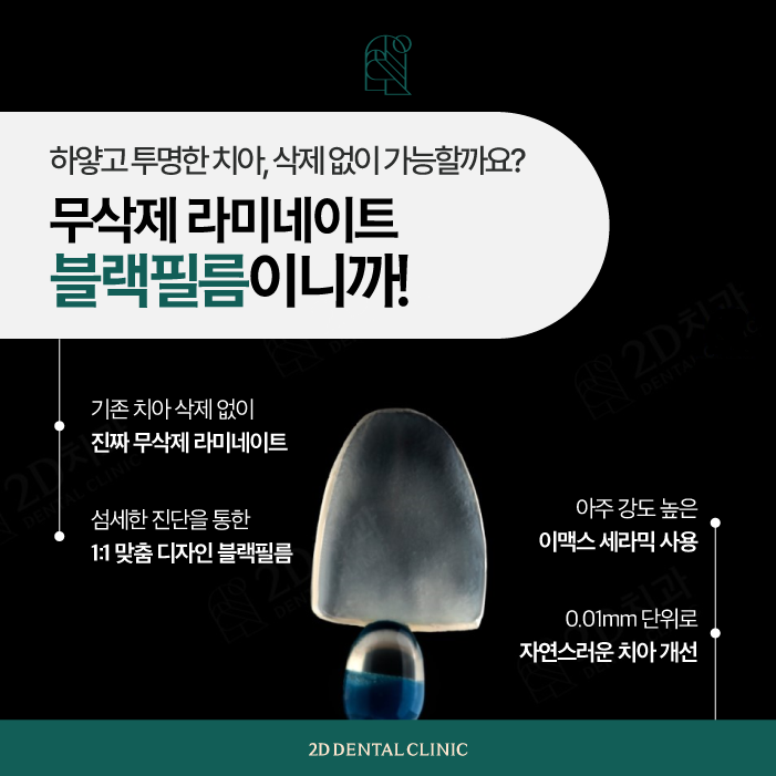 투디치과 무삭제블랙필름 아름다운 앞니 자신감 관련 이미지 4