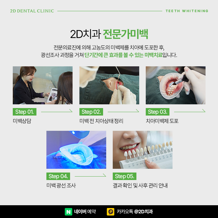 치과치아미백과 셀프치아미백 차이점은? 신논현 치과 치아미백가격 관련 이미지 4