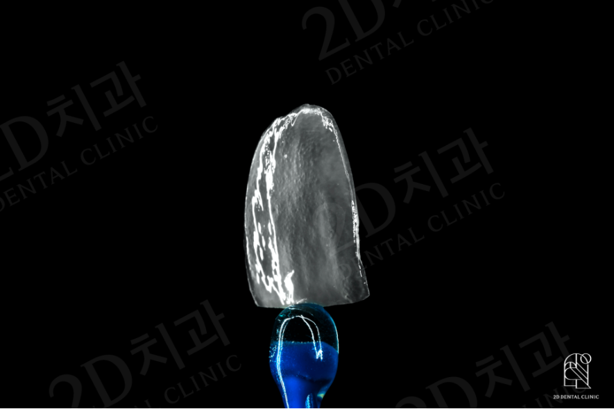 무삭제라미네이트 후기 모음 관련 이미지 3