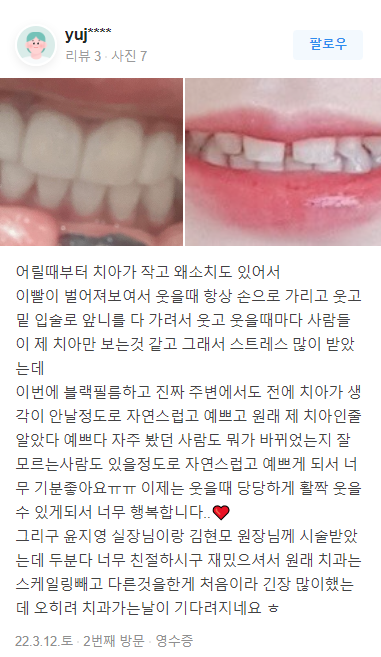 무삭제라미네이트 후기 모음 관련 이미지 8