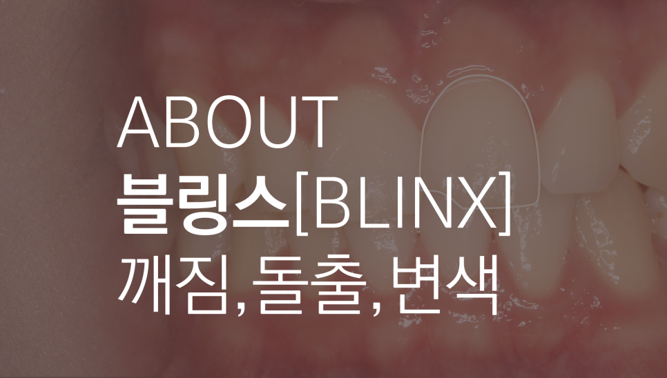 2D(투디)치과 블링스, 추천합니다!(깨진 앞니, 돌출앞니, 벌어진 앞니, 치아 노후, 치아 변색) 관련 이미지 1