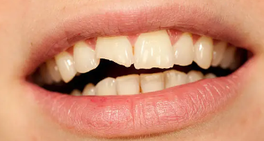 라미네이트 깨짐 10년 무상보증되는 블랙필름 관련 이미지 5