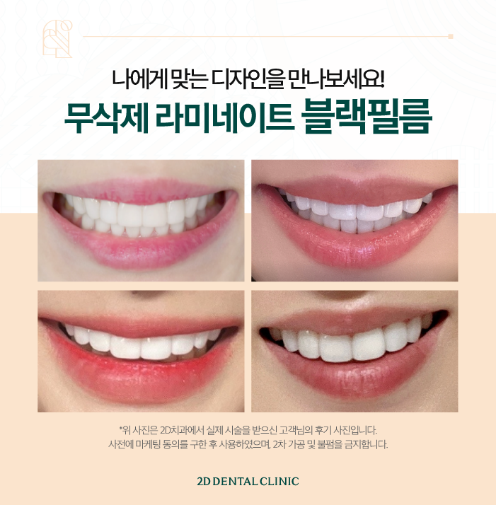 부산무삭제라미네이트 멀리서도 찾아주시는 블랙필름 관련 이미지 6