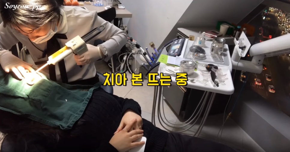 무삭제 라미네이트 쎄라필름, 정말 무삭제? [쎄라필름(TheraFilm)후기_유튜버 Soyeon_pp님] by. 투디치과(2D치과) 관련 이미지 17