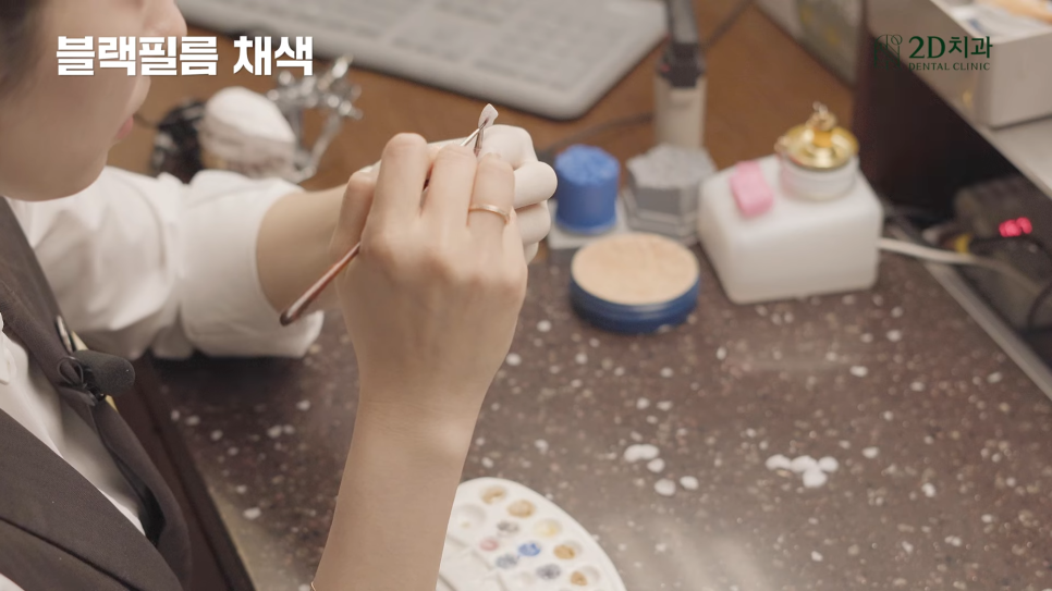 무삭제 라미네이트 블랙필름이 만들어지는 곳, 투디치과 아뜰리에 관련 이미지 6