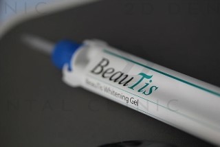 투디치과의 치아미백!! 관련 이미지 3