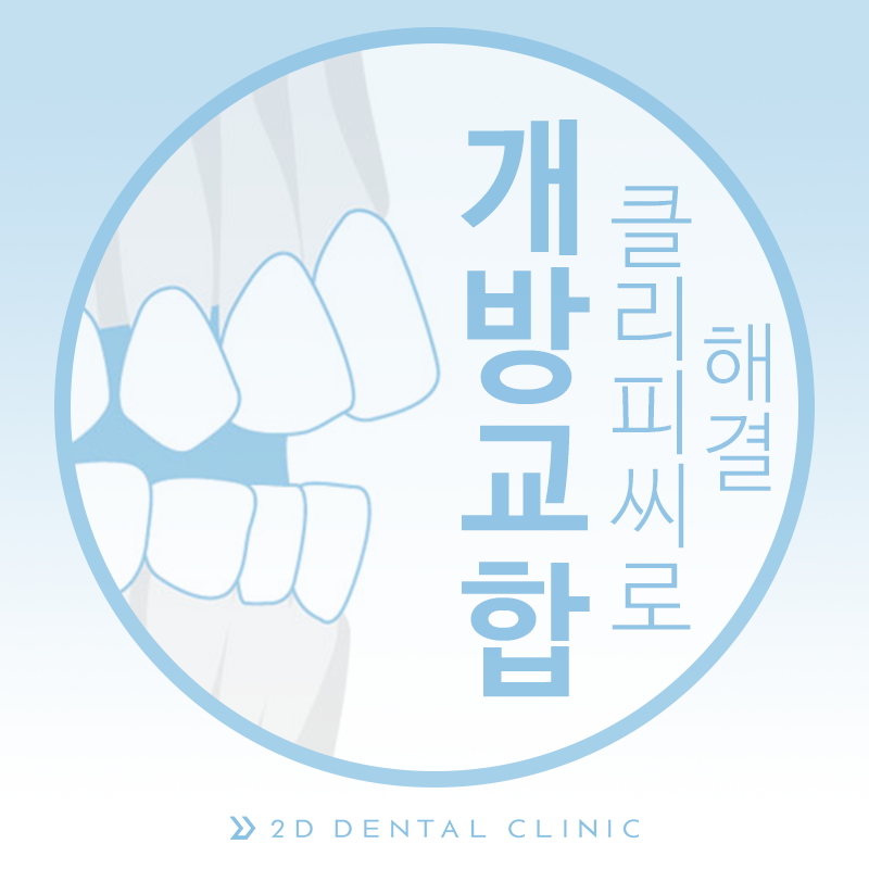 개방교합, 교정으로 잇몸질환 예방하자! 관련 이미지 2