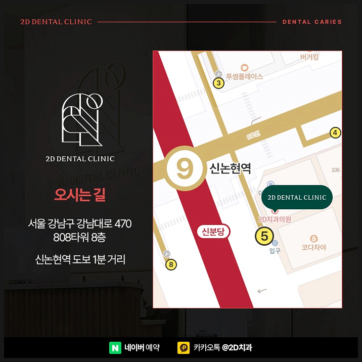 어금니충치치료 빠르게 진행해야 이유, 단계별 레진, 인레이, 크라운 순서 관련 이미지 11