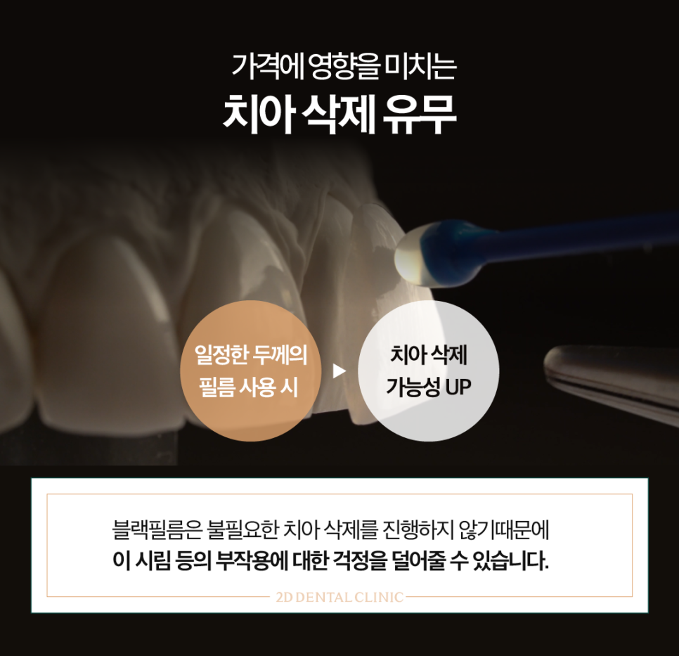 인천무삭제라미네이트 치아파절치료 5가지 꼭 확인하셔야 합니다 관련 이미지 4
