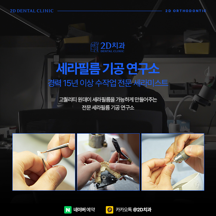 뻐드렁니 고민이라면 강남역 앞니부분교정 잘하는 치과 관련 이미지 6