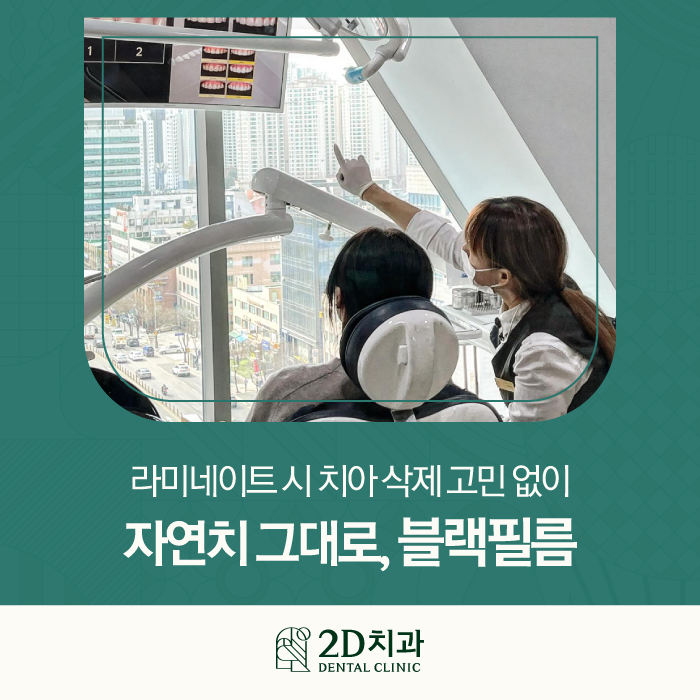 강남역라미네이트 잘하는곳 자연치 그대로 블랙필름 관련 이미지 1