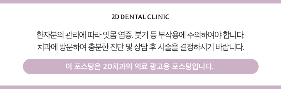 대구무삭제라미네이트 커피치아변색 누런 이 개선 가능할까요? 관련 이미지 12