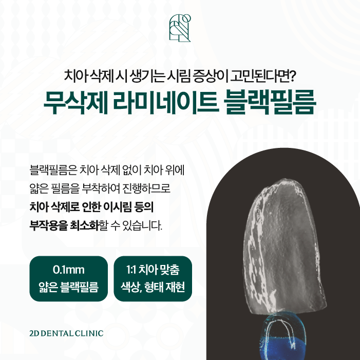 울퉁불퉁한 치아라인을 매끄럽게 무삭제라미네이트 블랙필름 관련 이미지 4