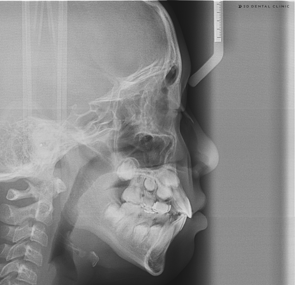 원칙을 지키는 교정전문 2D치과 관련 이미지 5