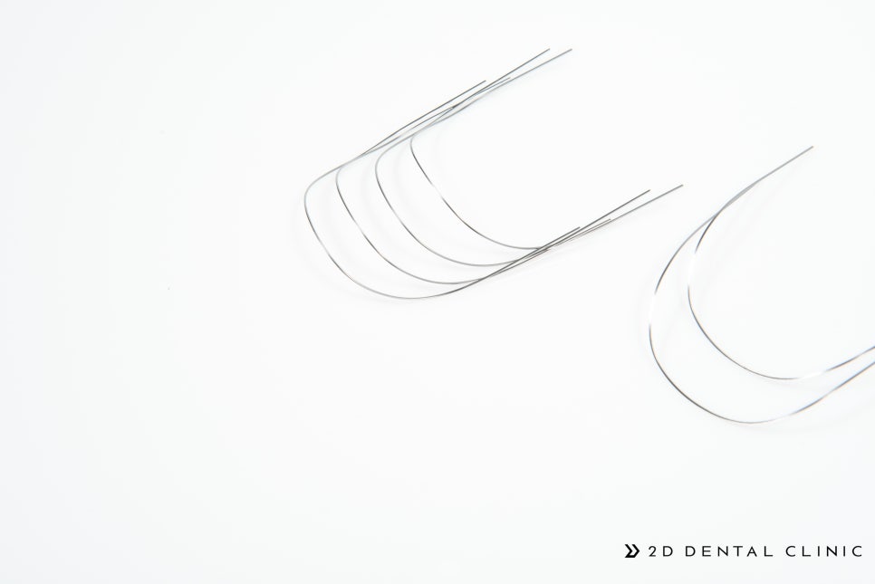 [투디(2D)치과] 교정 와이어의 종류 관련 이미지 5