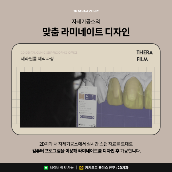 빠름 + 정교함 다 잡은 세라필름의 비결? 바로 관련 이미지 4