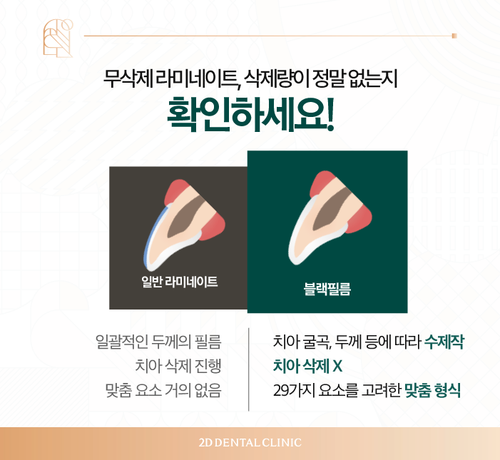 치아 삭제 없는 블랙필름 무삭제라미네이트후기 관련 이미지 5