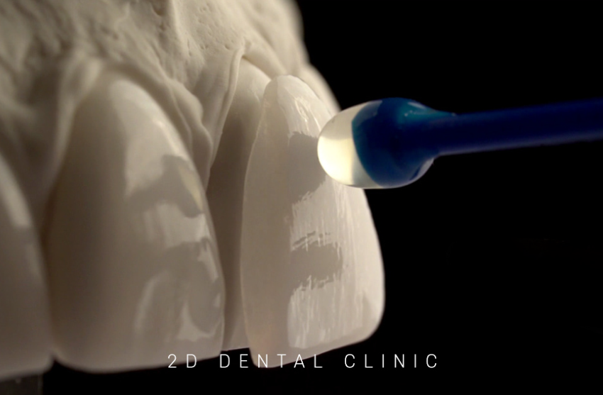 앞니라미네이트 잘하는 곳 : 2D치과 관련 이미지 3