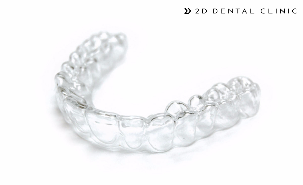 대학생 방학기간, 빠르고 간편한 1Day(원데이) 투명교정! 관련 이미지 5