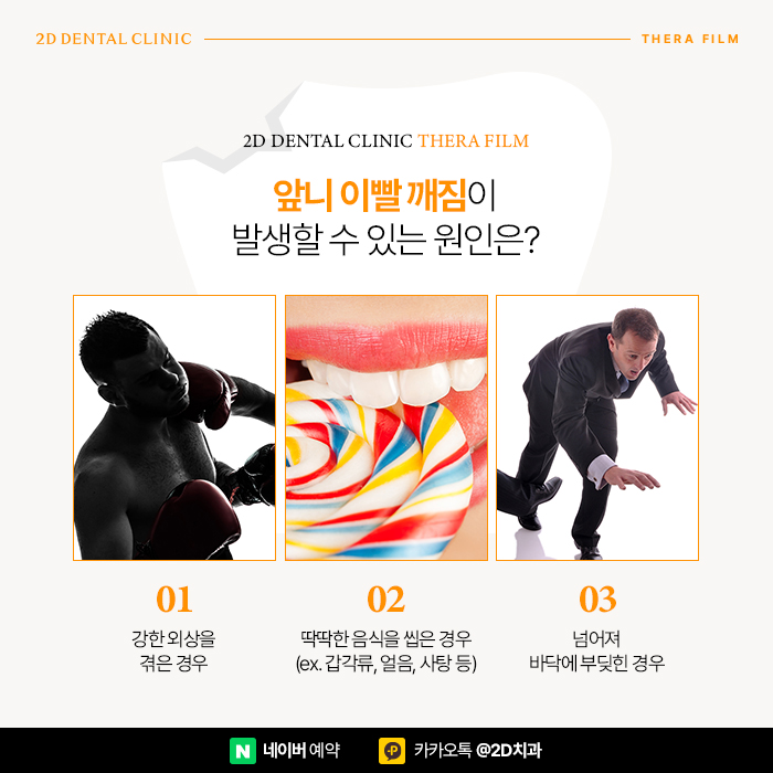 앞니 이빨깨짐 발생했을 때는? 치과라미네이트로! 논현역 세라필름 관련 이미지 2