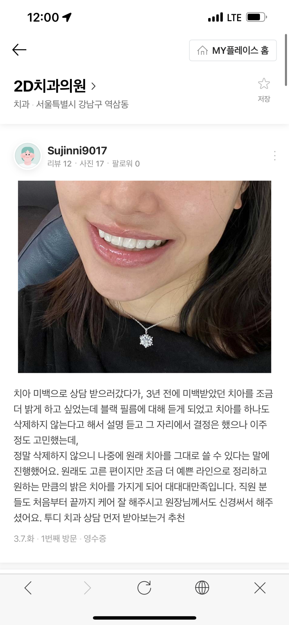 라미네이트 빠짐 대처법 관련 이미지 5