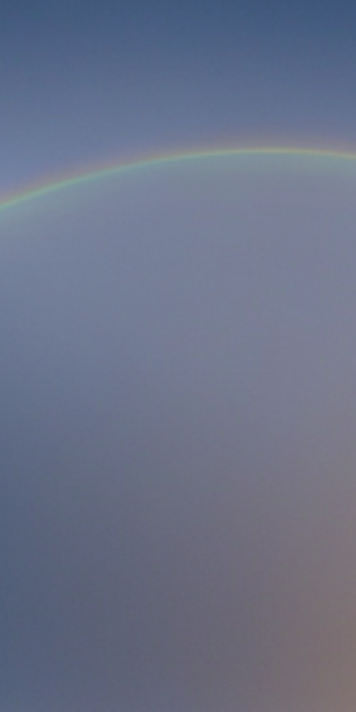 무삭제 라미네이트비용 특징 알아보자 관련 이미지 13