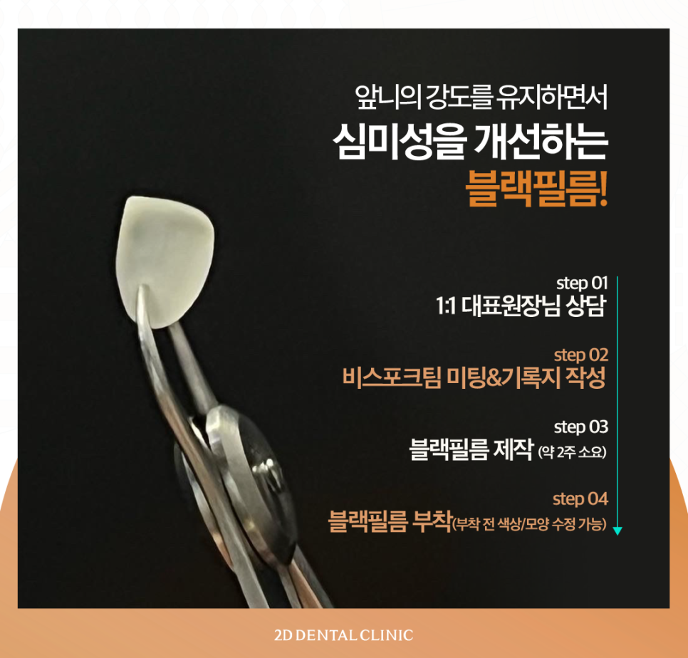 부산무삭제라미네이트 영구치앞니깨짐 어떻게 해야 좋을까요? 관련 이미지 6