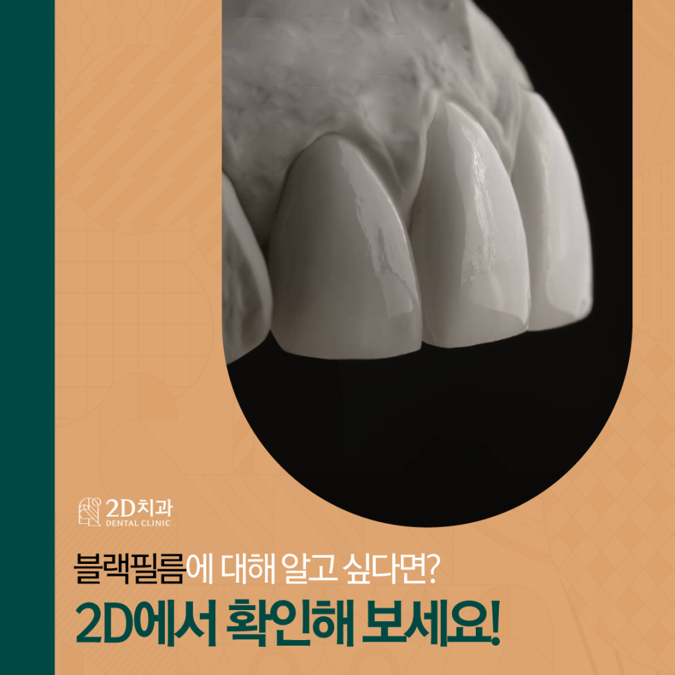 라미네이트 무삭제블랙필름 치아변색 고민, 해결은? 관련 이미지 1