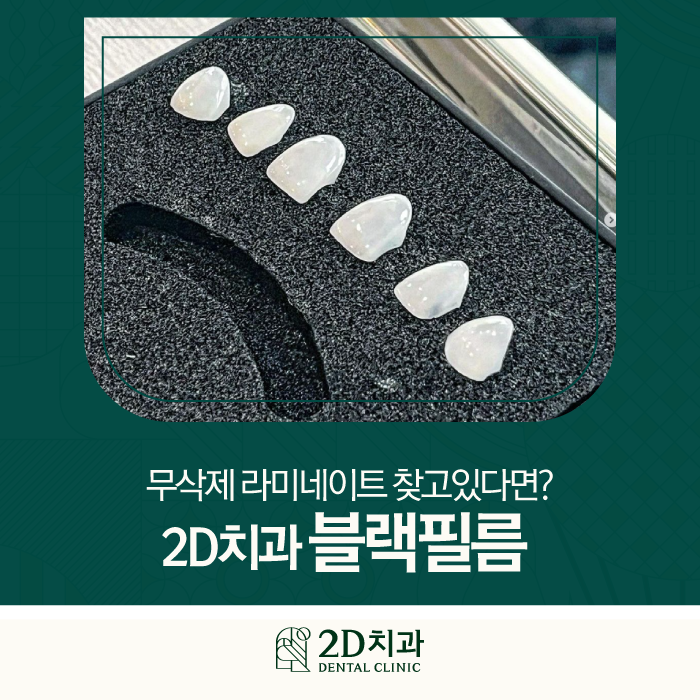 무삭제라미네이트가격 블랙필름이 인기 많은 이유는? 관련 이미지 1