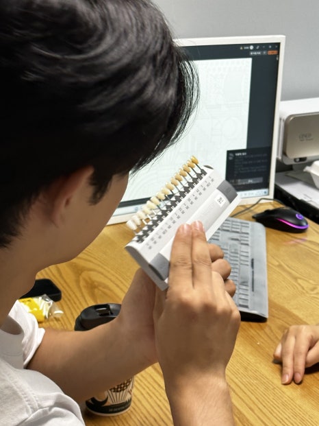 치아변색 치아착색 고민해결은 무삭제라미네이트 블랙필름 관련 이미지 6