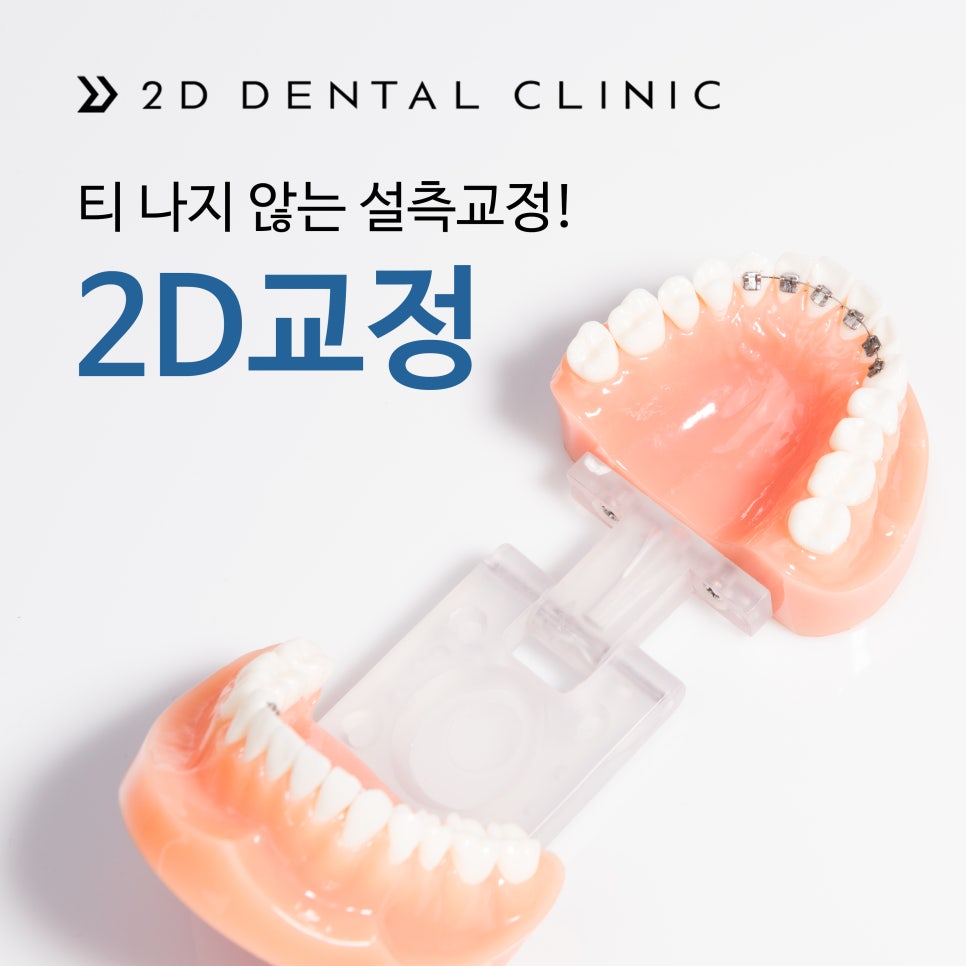 [투디(2D)치과] 앞니부분교정 2D교정 추천드리는 이유. 관련 이미지 2