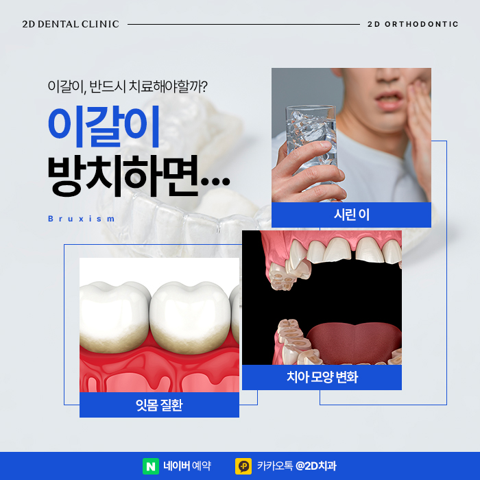 이갈이방지, 티 안 나는 치열교정으로 신논현 투명교정 관련 이미지 3