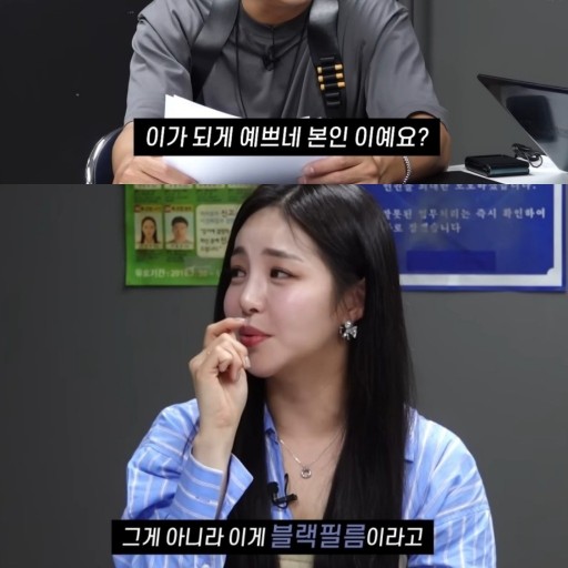 라미네이트 통증없는 2회 방문으로 시술 가능한 블랙필름 관련 이미지 3