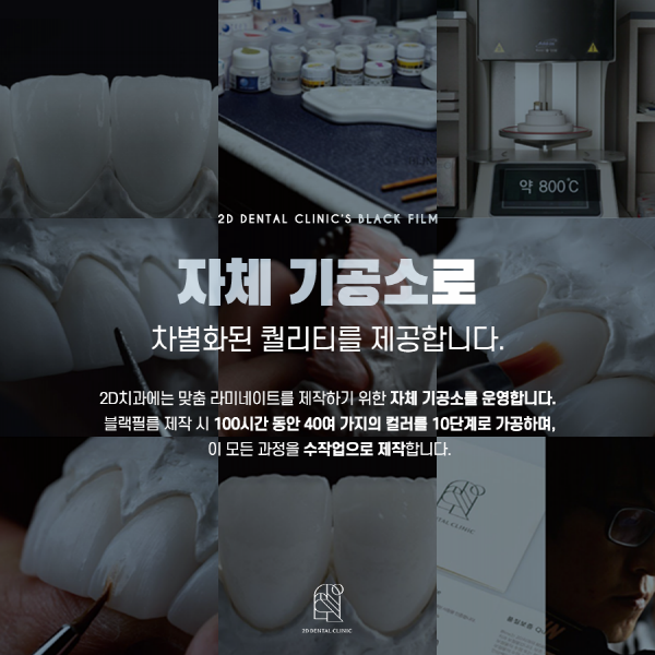 "이건 몰랐지?" 프리미엄 앞니 라미네이트 <블랙필름> 관련 이미지 6