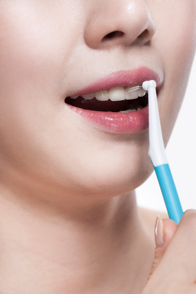 라미네이트빠짐? 원인과 대처, 재부착 주의 사항까지 관련 이미지 5