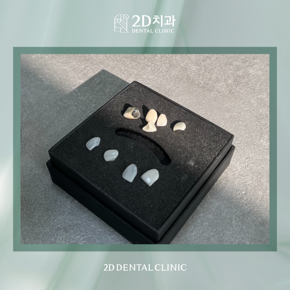 무삭제라미네이트후기 치아미백비용 환한 미소로 자신감 있게! 관련 이미지 2