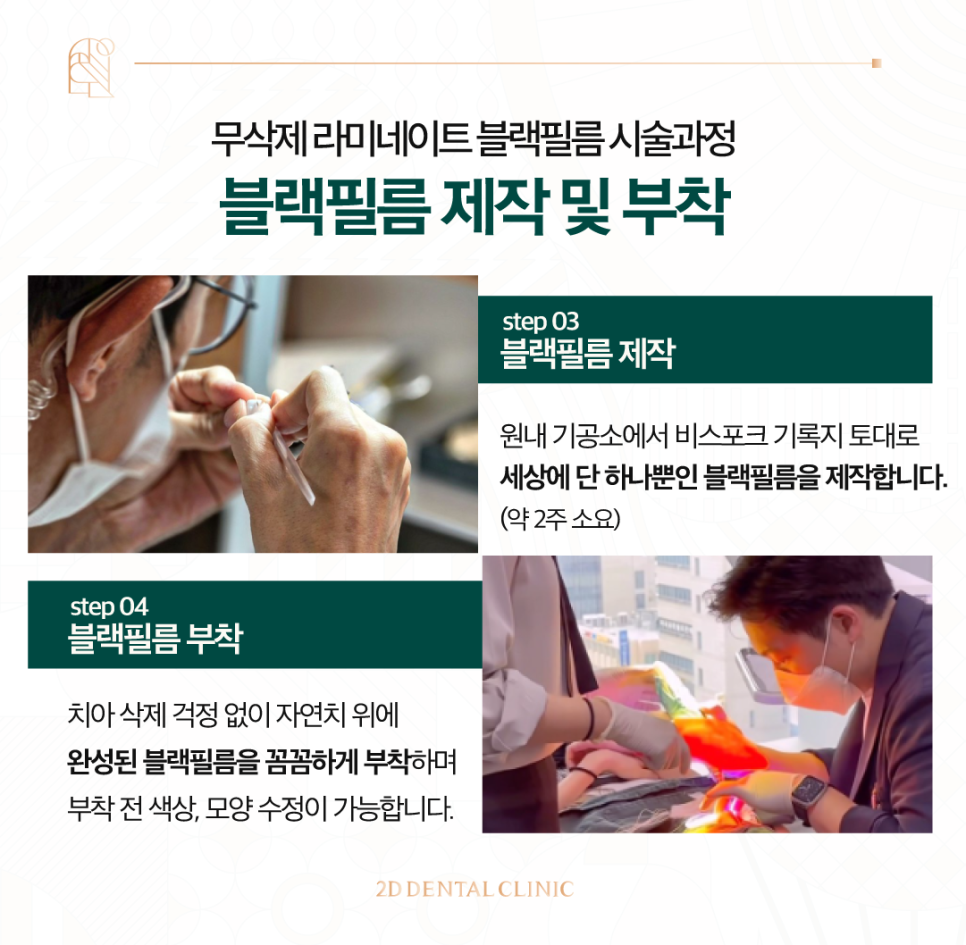 강남라미네이트 앞니교정 블랙필름 이렇게 만들어집니다! 관련 이미지 5