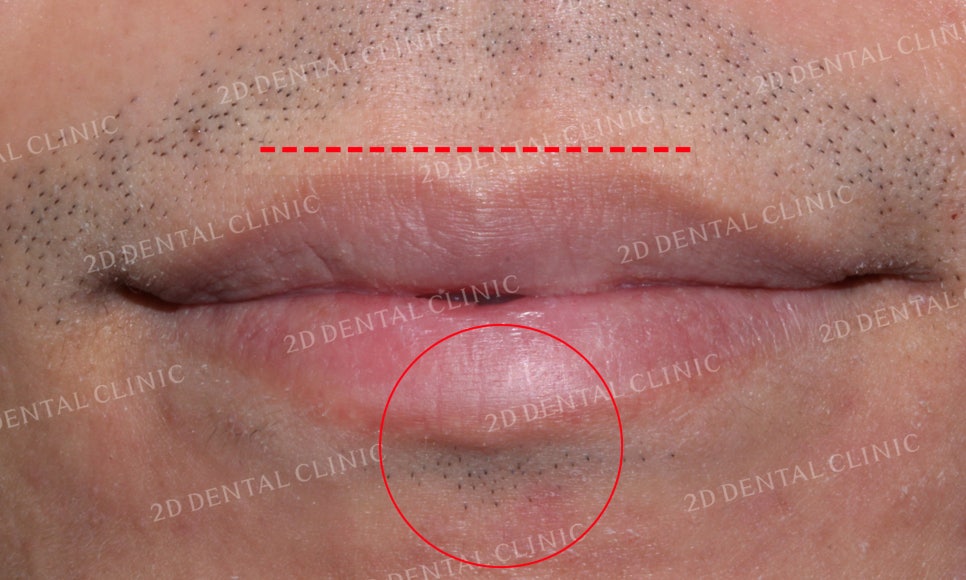 틀어진 앞니를 전체 교정으로 바르게! by.투디치과(2D치과) 관련 이미지 10