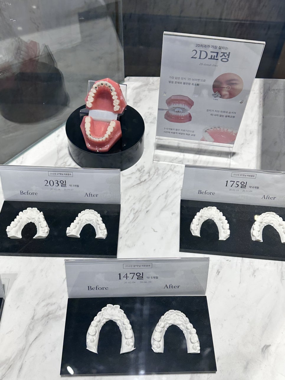 무삭제라미네이트후기 블랙필름의 장점 관련 이미지 8