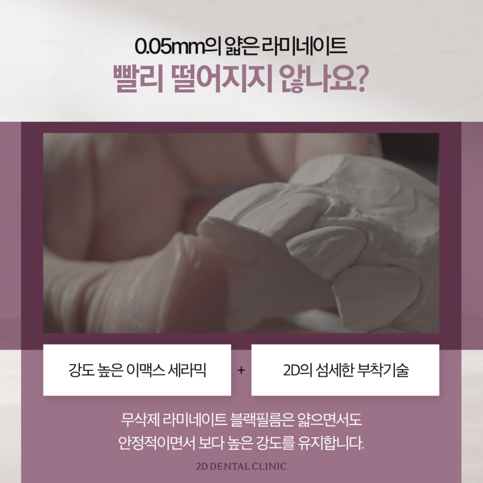 무삭제라미네이트비용 앞니살짝깨짐 더욱 큰 손상을 막기 위해서 관련 이미지 5
