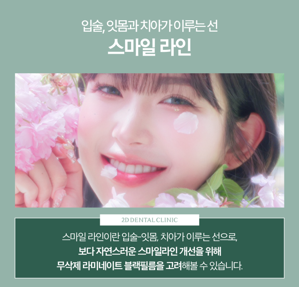 무삭제라미네이트후기 치아미백비용 환한 미소로 자신감 있게! 관련 이미지 3