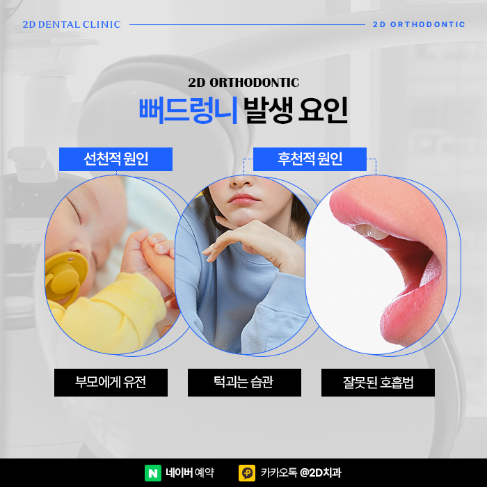 뻐드렁니 고민이라면 강남역 앞니부분교정 잘하는 치과 관련 이미지 2