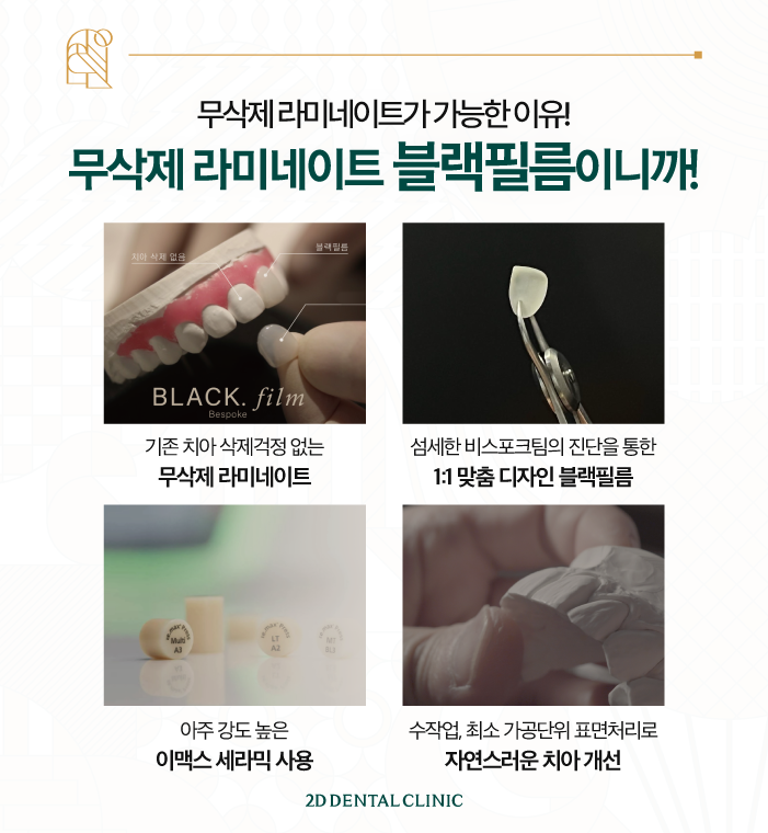 강남라미네이트치과 신논현치과 라미네이트를 고민하고 있다면 관련 이미지 4