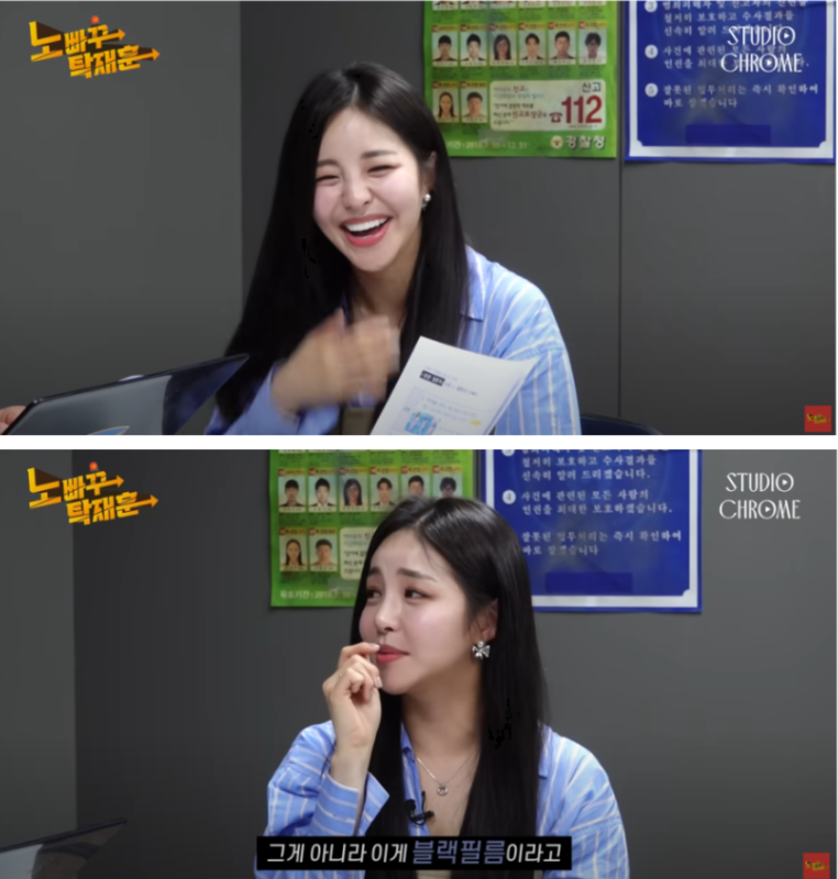 라미네이트치료 치아손상없는 무삭제라미네이트 블랙필름 관련 이미지 5