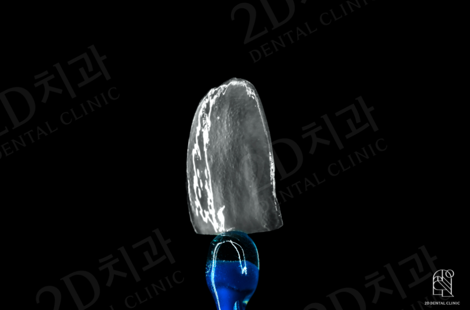 블랙필름 치과 2D치과 앞니라미네이트 관련 이미지 2