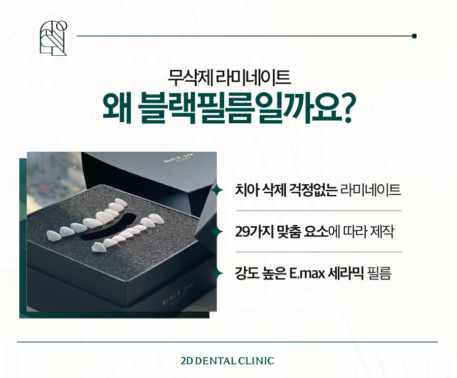 무삭제라미네이트비용 돈 아깝지 않은 블랙필름 관련 이미지 3