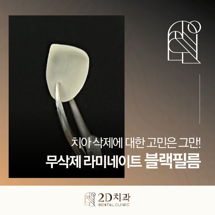 무삭제라미네이트부작용 앞니깨짐 블랙필름으로 걱정 줄이세요! 관련 이미지 1
